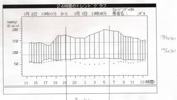 C:\Documents and Settings\KUWAKI@KEIICHI\fXNgbv\My Pictures\ABPM\ABPM 003.jpg